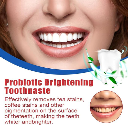 SP-4 ultra Whitening Probiotic Paste (Free Delivery 🚚)