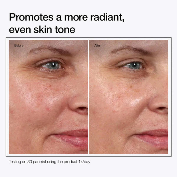 Glycolic Acid 7% Toning Solution (Free Delivery 🚚)
