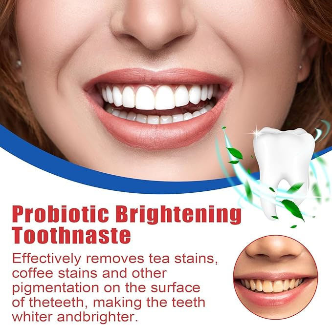 SP-4 Probiotic Whitening Paste (Free Delivery 🚚)