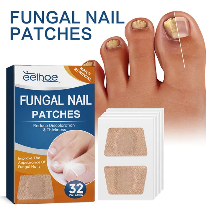 Fungal Nail Patches (Free Delivery 🚚)