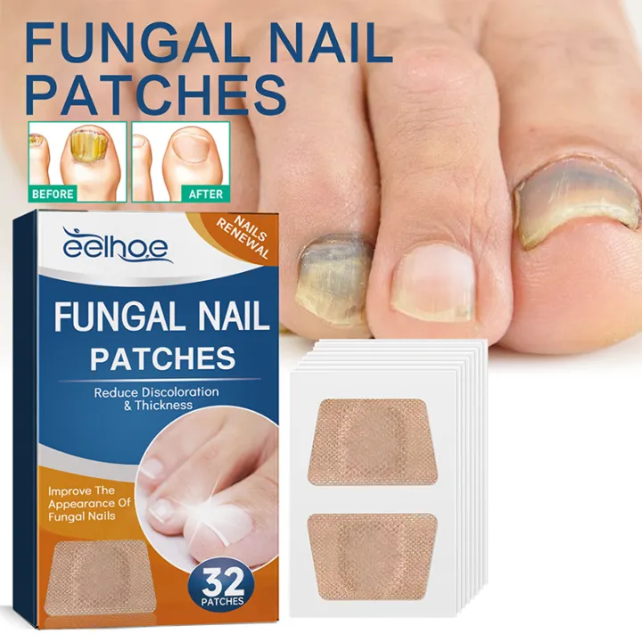 Fungal Nail Patches (Free Delivery 🚚)