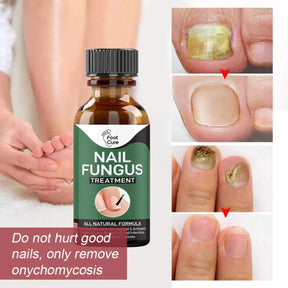 Anti-Funguses Nail Treatment Oil