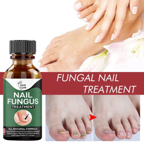 Anti-Funguses Nail Treatment Oil