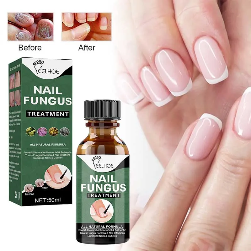 Anti-Funguses Nail Treatment Oil